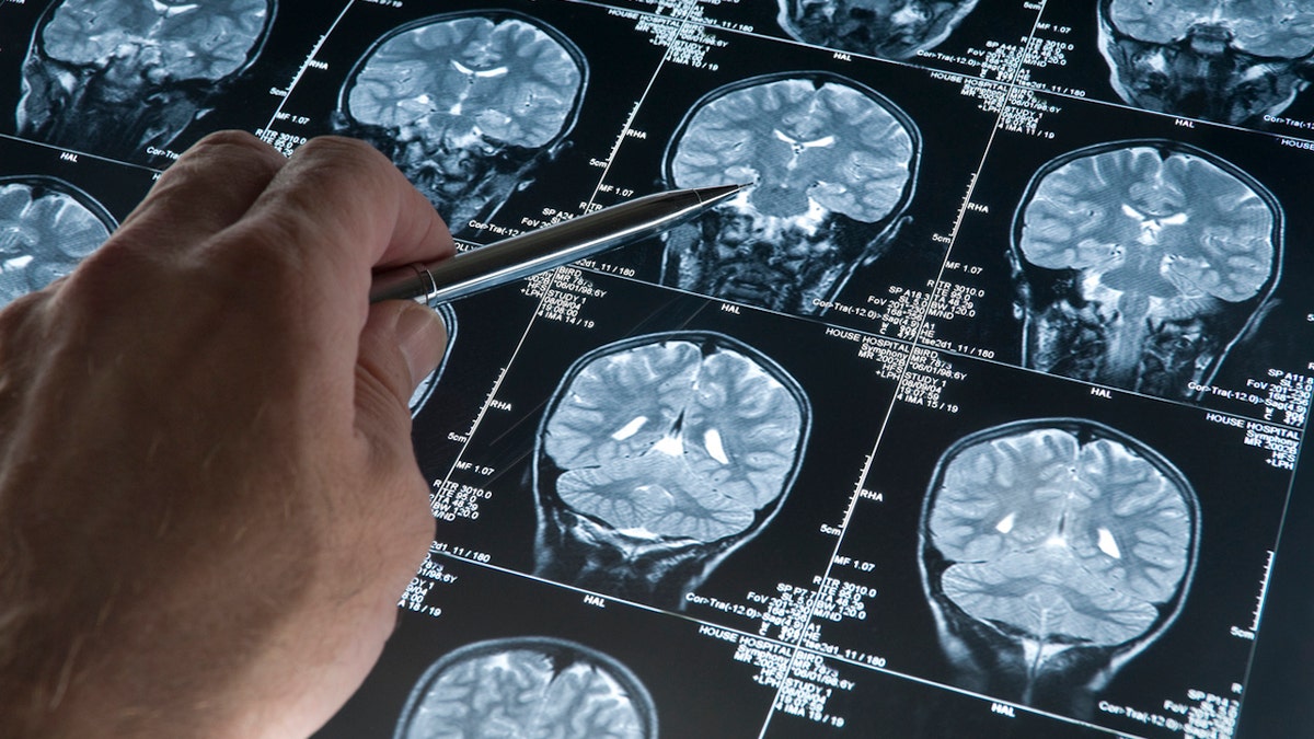 Brain explorations